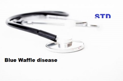 Blue Waffle disease
